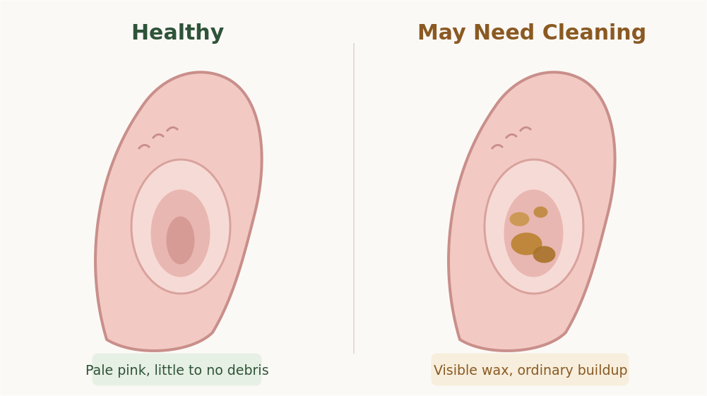 Healthy cat ear compared with an ear showing wax buildup and abnormal dark debris